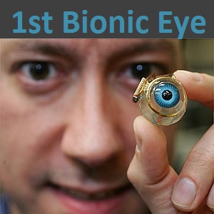 Argus Bionic Eye